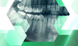 SERIES CÔNG TRÌNH KHOA HỌC TIÊU BIỂU: PHẦN MỀM CHẨN ĐOÁN BỆNH DỰA TRÊN ẢNH X-QUANG NHA KHOA VNU-DIAGNOSIS